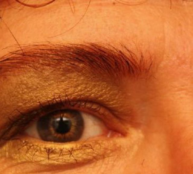 Zehe56 - Nach längerer Zeit wieder bereit!